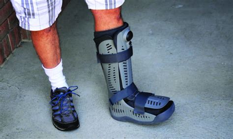 <strong>After</strong> an injury or operation, your surgeon or physiotherapist may ask you to be partial <strong>weight bearing</strong>. . Walking after 6 weeks non weight bearing ankle